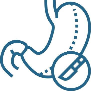 General & Laparoscopic Surgery