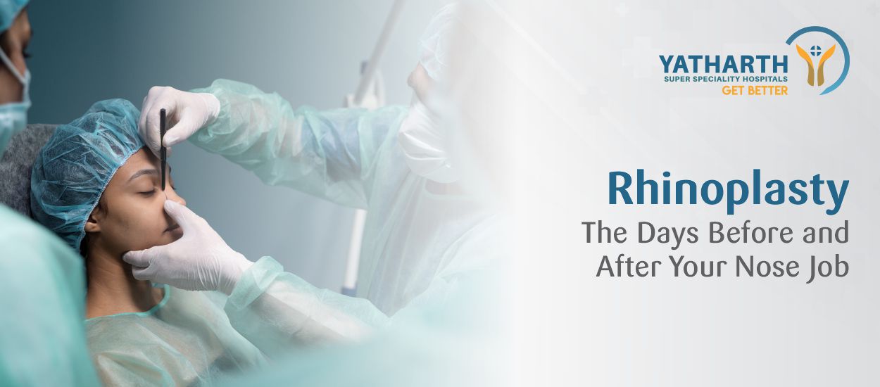 Rhinoplasty: The Days Before and After Your Nose Job